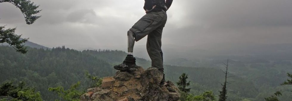 Aktív élet sportprotézissel